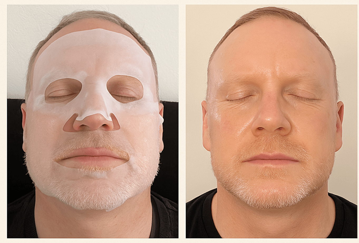 Male before and after results with Liornelle collagen mask – skin texture improved. Men’s skincare transformation – Lionelle collagen mask for hydrated and refreshed skin.