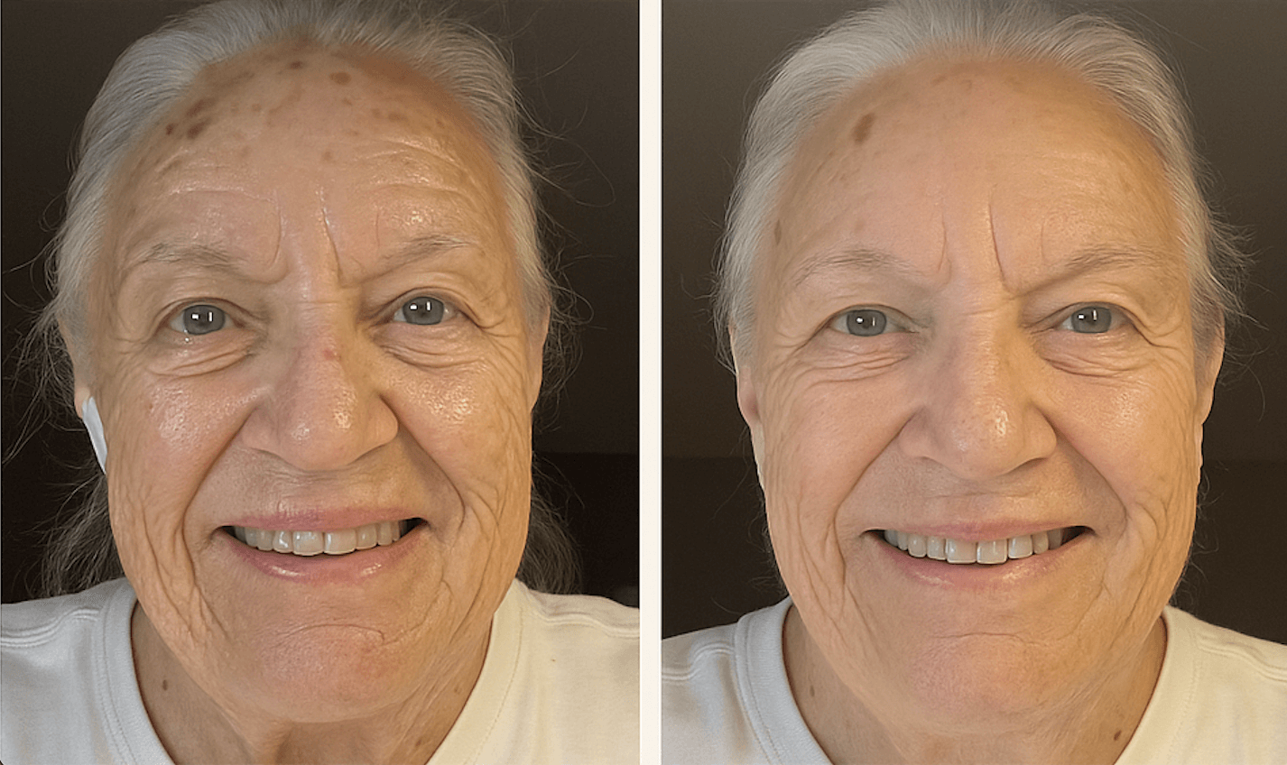 Visible hydration and firmness on mature skin using Lionelle capsule cream.