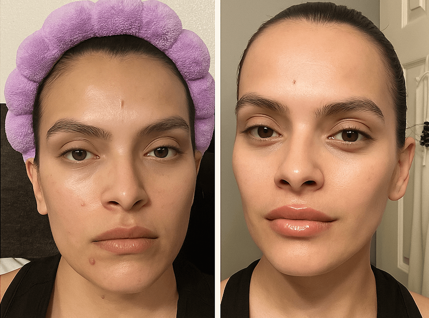 Female user shows clear improvement in dull skin, with radiance and even texture after Beginner Ritual.  Glowing, smooth complexion after serum application.